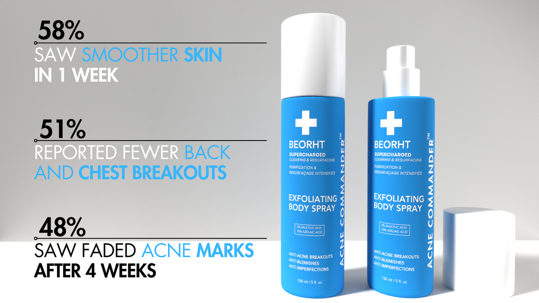 How Does Acne Commander's Exfoliating Body Spray Work, and Why Is It More Effective Than Others?