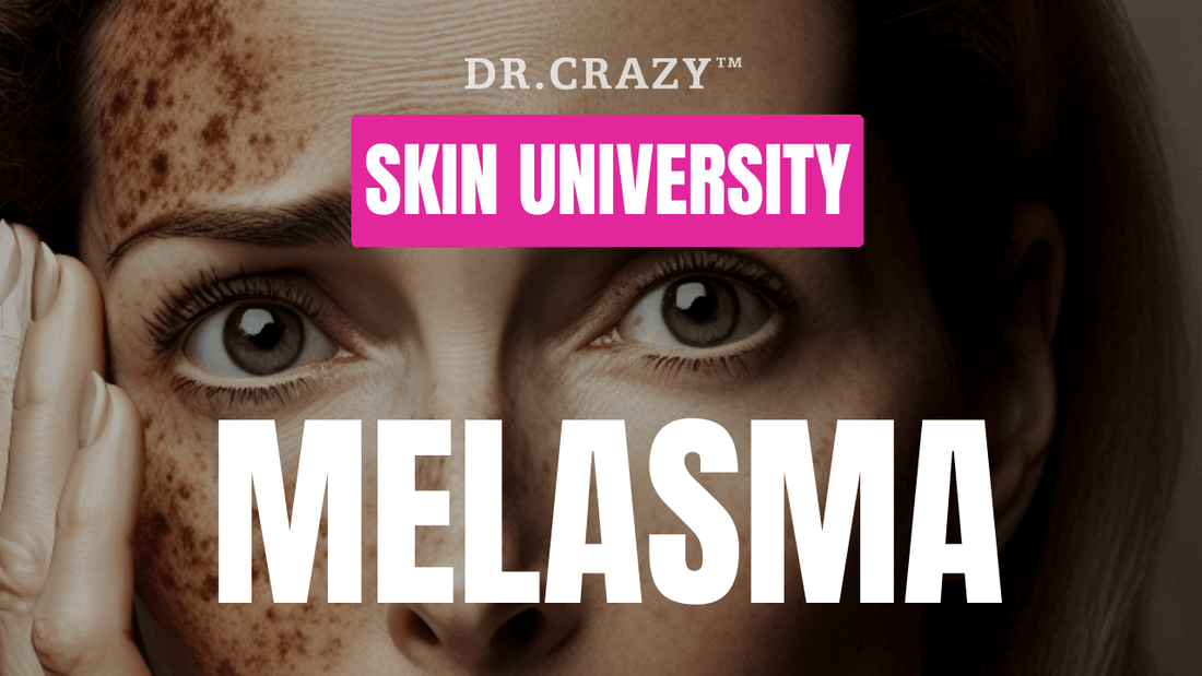 Melasma: How to Treat and Lighten Melasma for a Clearer Complexion