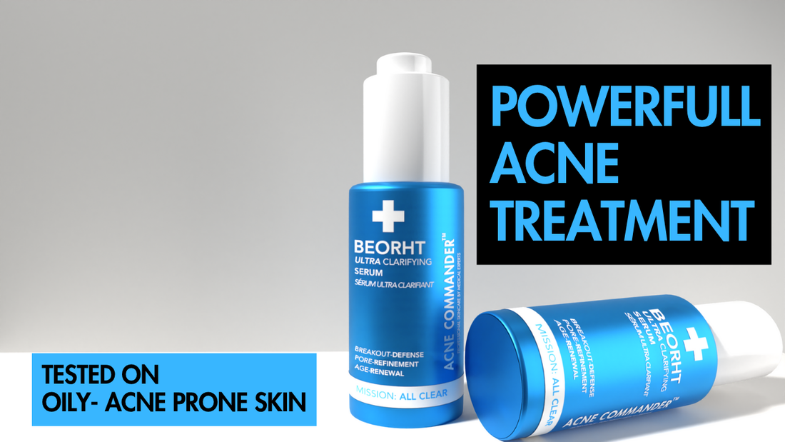 Acne Commander's Beorht Moisturiser For Acne Prone Skin