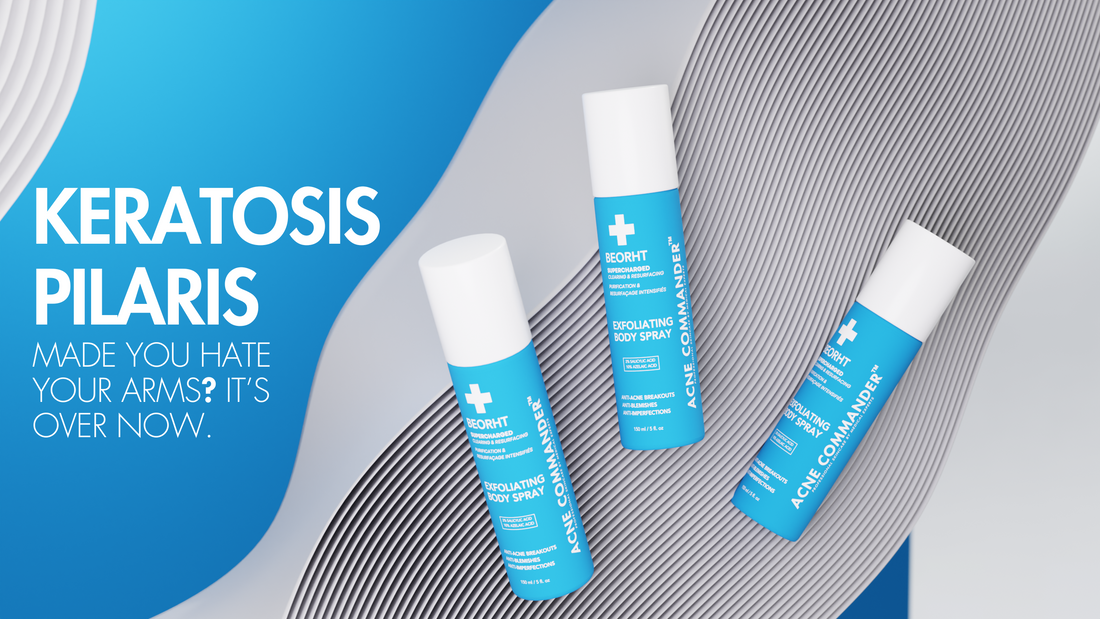 Can Body Acne Sprays Help with Keratosis Pilaris?