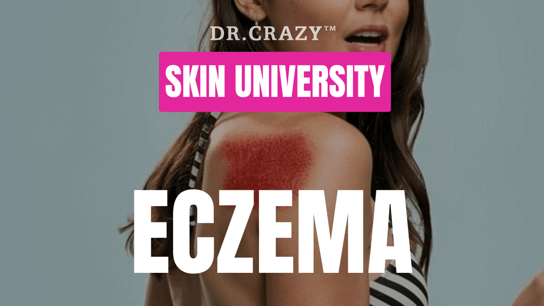 Eczema: Effective Treatments for Dry, Itchy Skin and How to Prevent Flare-Ups