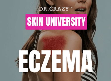 Eczema: Effective Treatments for Dry, Itchy Skin and How to Prevent Flare-Ups