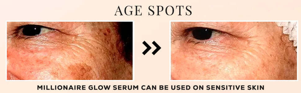 Secrets to Transform Dull Skin: Your Complete Guide