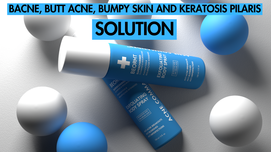 Does Salicylic Acid Help with Back Acne?