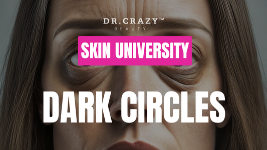 Dark Circles: How to Reduce Dark Circles Under Eyes and Brighten Your Skin