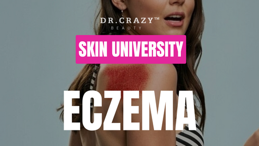 Eczema: Effective Treatments for Dry, Itchy Skin and How to Prevent Flare-Ups