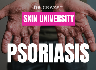 Psoriasis: How to Manage and Treat This Chronic Skin Condition