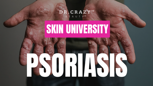 Psoriasis: How to Manage and Treat This Chronic Skin Condition