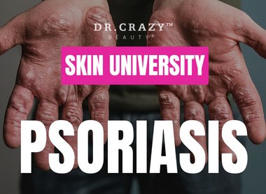 Psoriasis: How to Manage and Treat This Chronic Skin Condition
