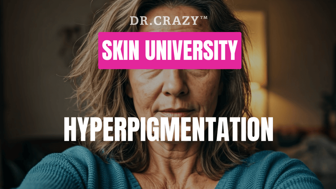 Hyperpigmentation: How to Get Rid of Dark Spots and Achieve Even Skin Tone