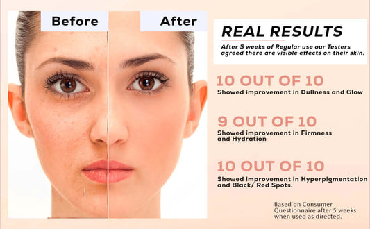 6 Most Important Facts About Dull Skin