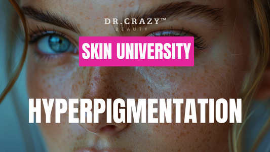 Hyperpigmentation: How to Get Rid of Dark Spots and Achieve Even Skin Tone