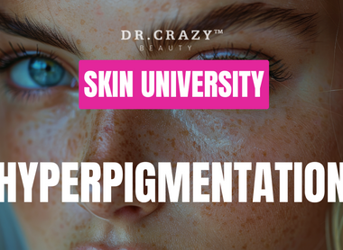 Hyperpigmentation: How to Get Rid of Dark Spots and Achieve Even Skin Tone