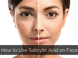 Salicylic Acid for Acne: How It Actually Works on the Follicle