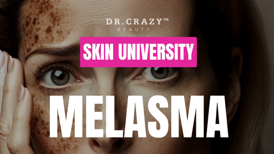 Melasma: How to Treat and Lighten Melasma for a Clearer Complexion