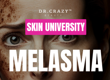Melasma: How to Treat and Lighten Melasma for a Clearer Complexion