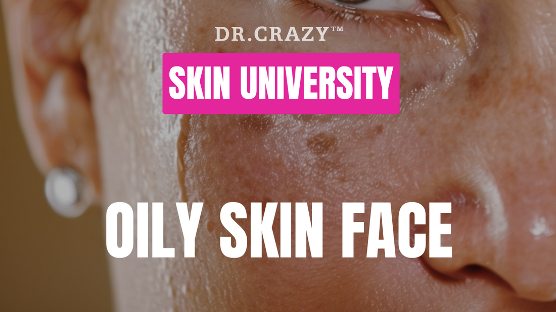 Oily Skin: How to Control Excess Oil and Achieve a Matte, Healthy Complexion