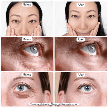 BAG BUSTER | INSTANT EYE BAGS REMOVER