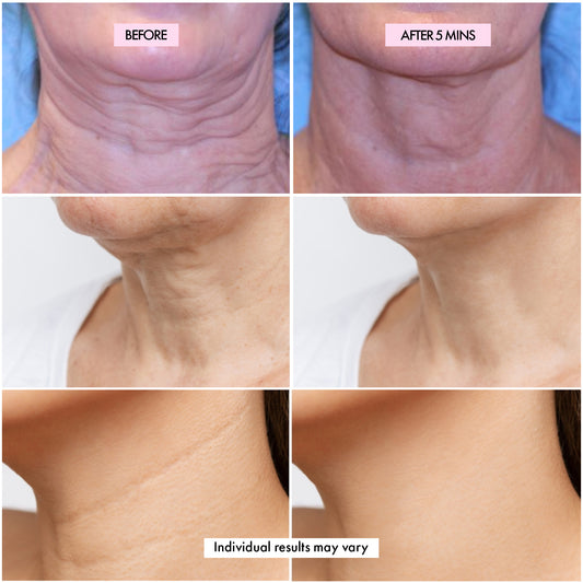 Instant Firming and Anti-Wrinkle Neck & Décolleté Serum