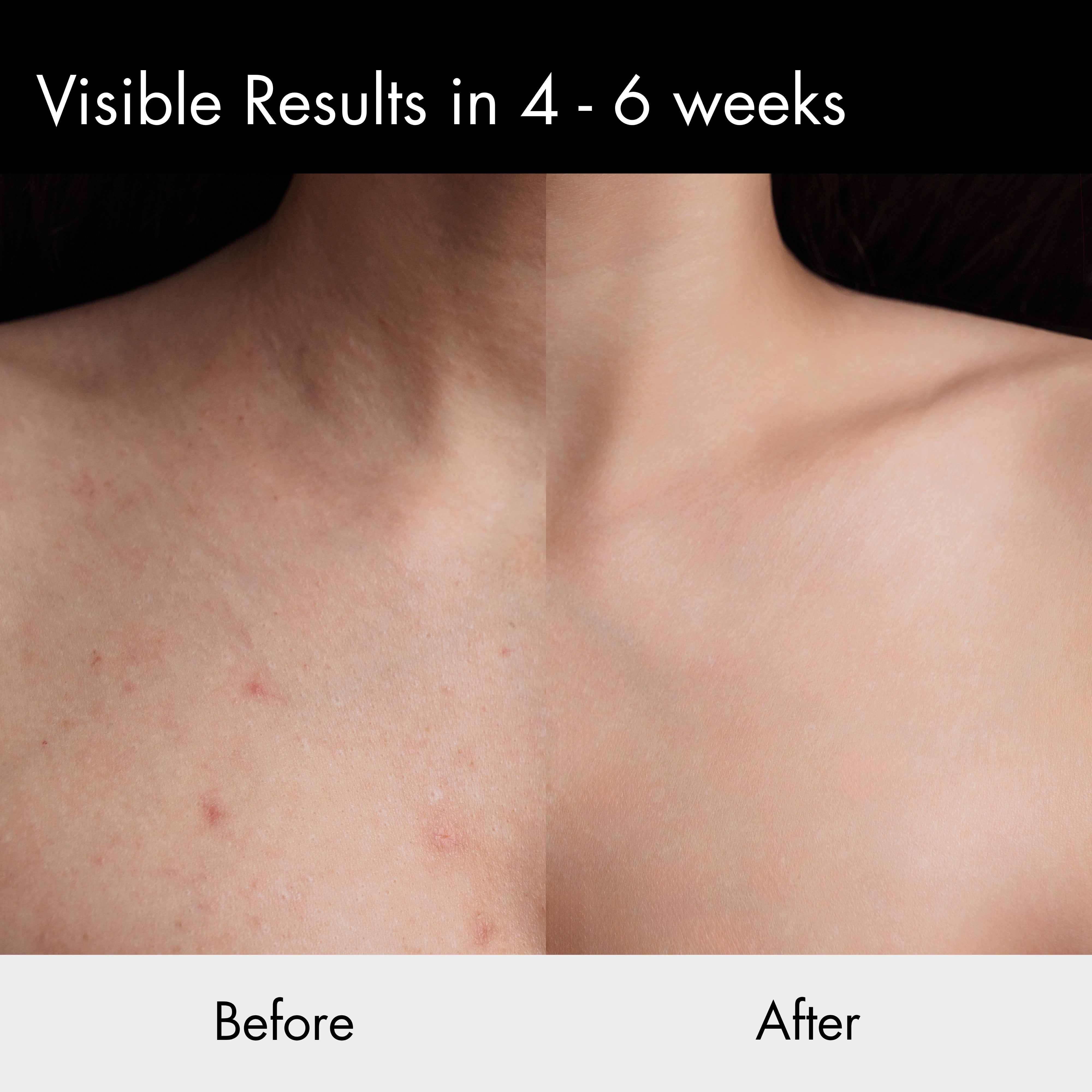 Beorht Exfoliating Body Spray