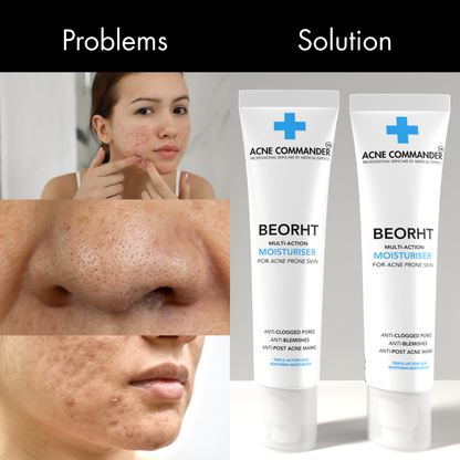 Beorht Moisturiser For Acne Prone Skin
