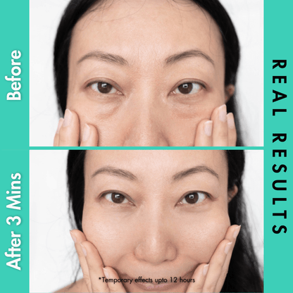 bag buster before and after, Dr. Crazy bag buster reviews