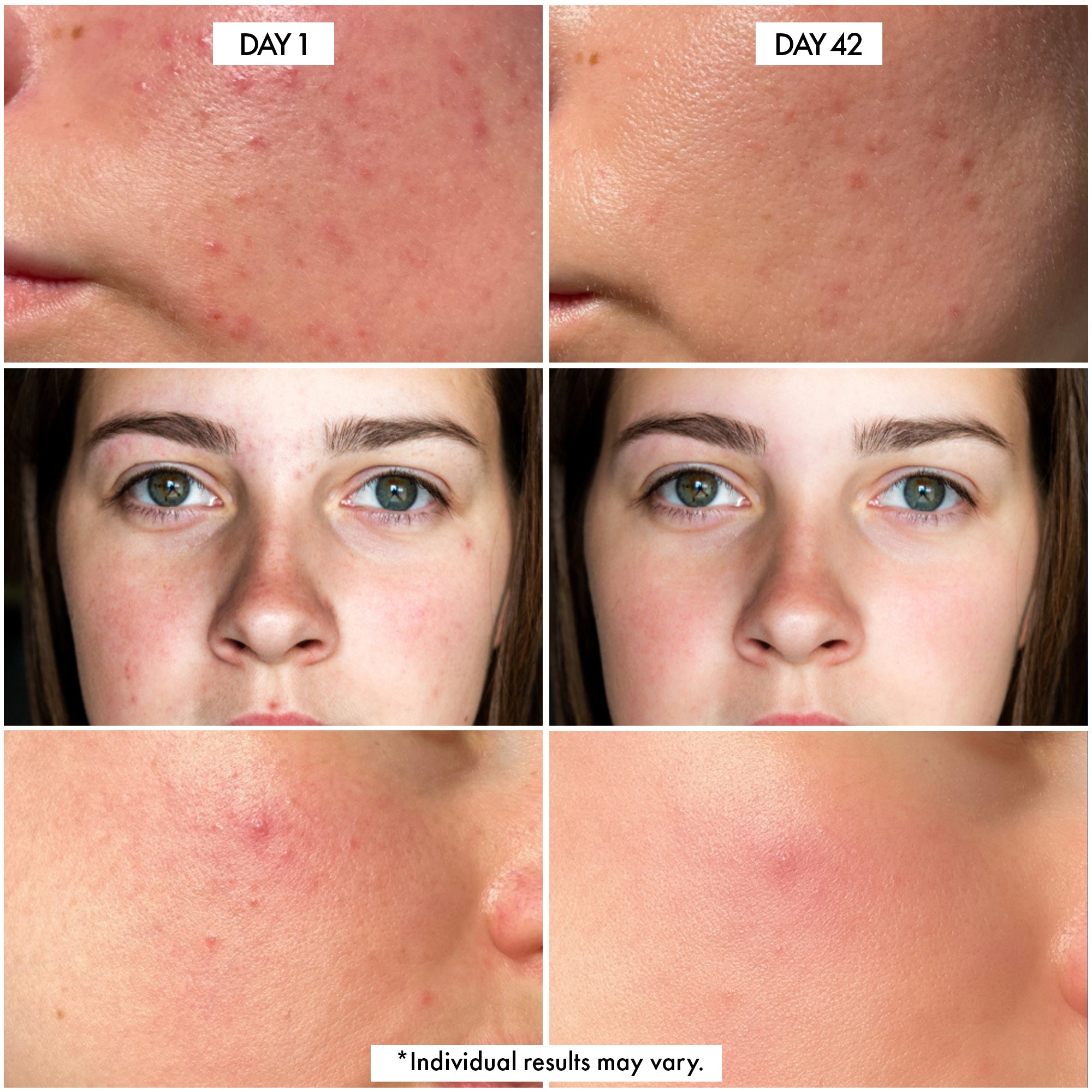 Millionaire Glow Serum – Brightening Vitamin C & Snail Mucin Glow Serum for Face & Neck