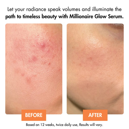MILLIONAIRE GLOW | AUSTRALIA'S BEST GLOW SERUM FOR FACE AND NECK