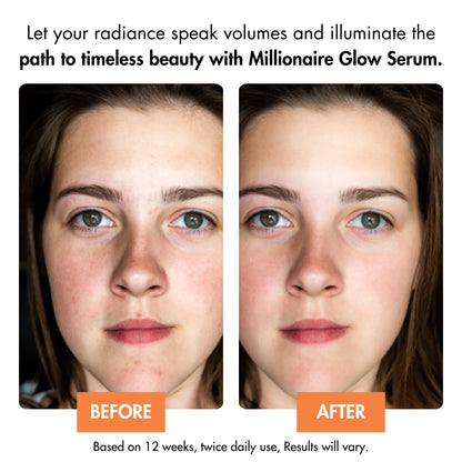 MILLIONAIRE GLOW | AUSTRALIA'S BEST GLOW SERUM FOR FACE AND NECK