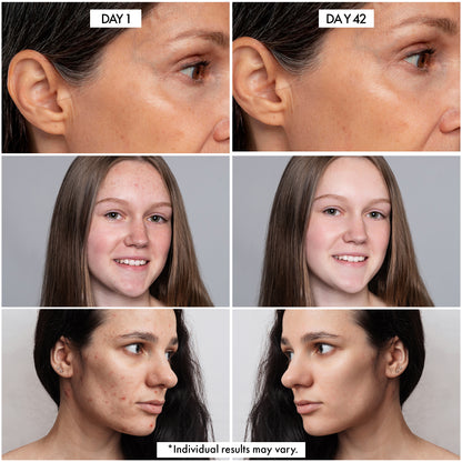 Millionaire Glow Serum – Brightening Vitamin C & Snail Mucin Glow Serum for Face & Neck