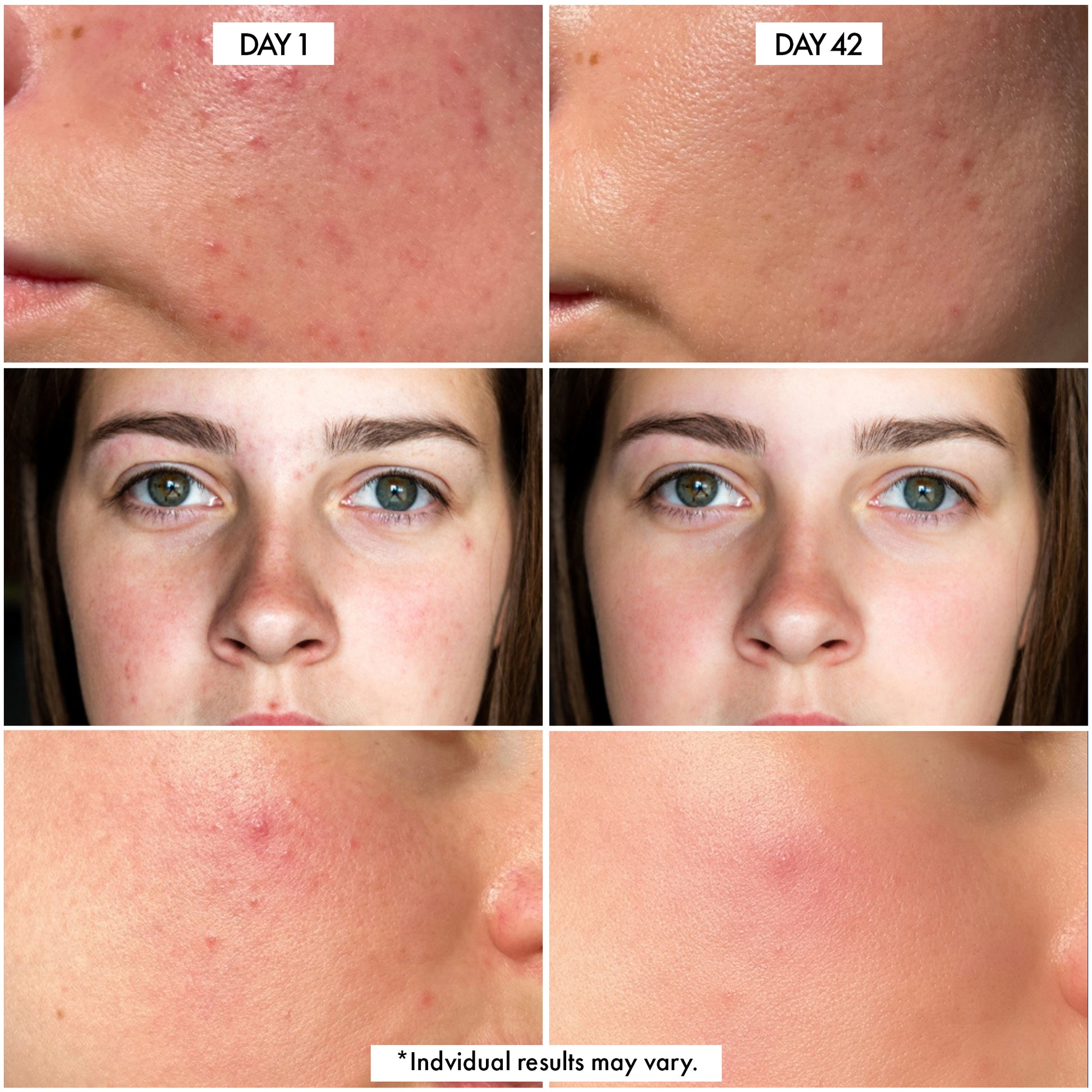 Before/After Millionaire Glow Serum by Dr Crazy Beauty