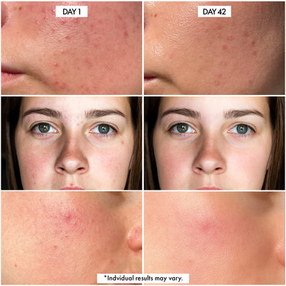 Before/After Millionaire Glow Serum by Dr Crazy Beauty