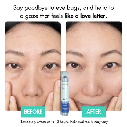 Best under eye bags cream in australia reviews