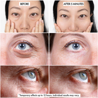 Before/After of Bag Buster by Dr Crazy Beauty
