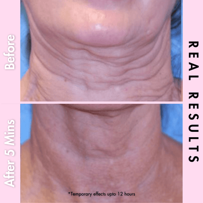 neck firming by  dr crazy reviews